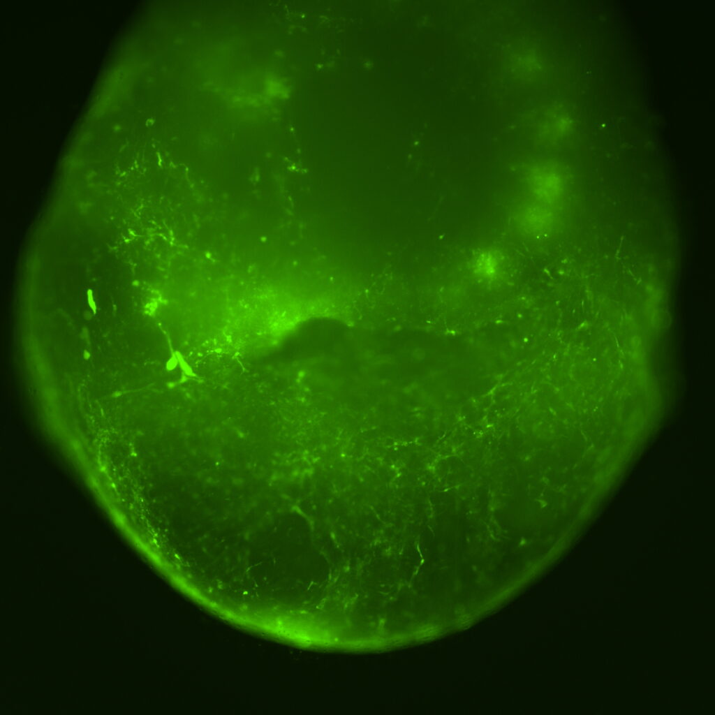 A beautiful glowing green mini-brain, show that the method of gene therapy works.